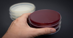 Microbiology laboratory service